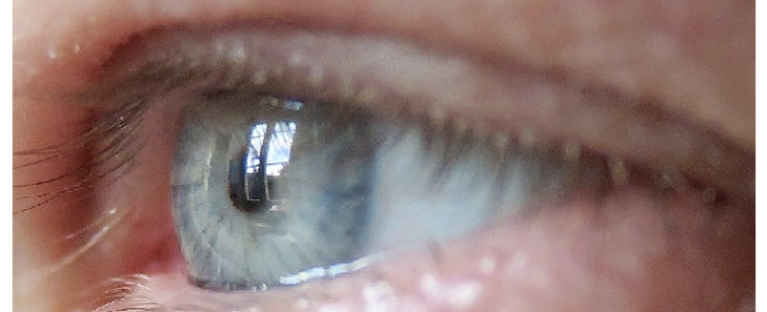 Eye