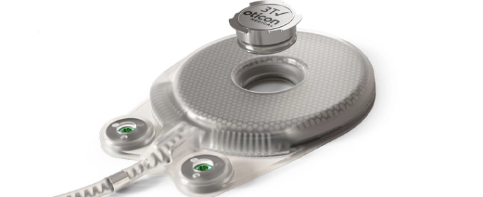 Neuro-Tzi-Hearing-Implant