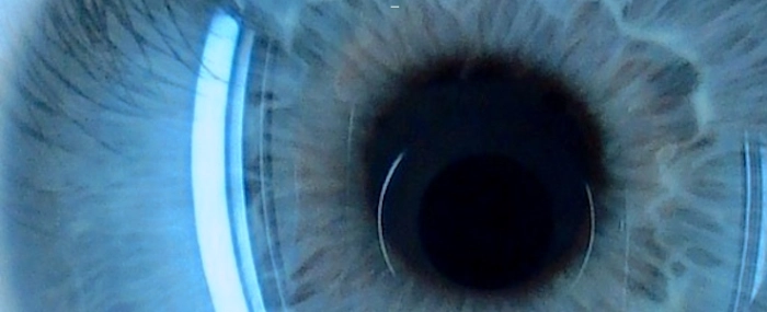 via_Wiki_eye_iris