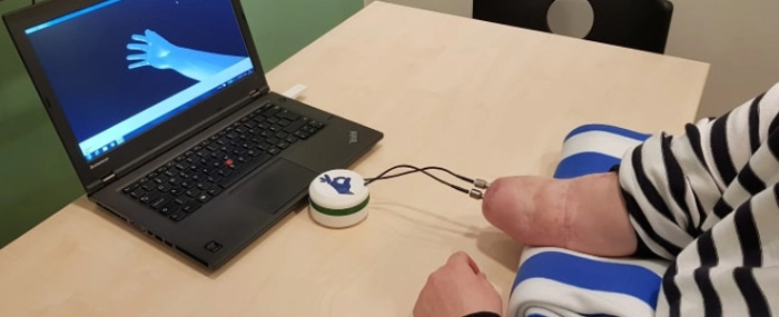 Prosthetic-Arm