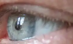 Eye