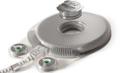 Neuro-Tzi-Hearing-Implant