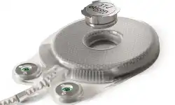 Neuro-Tzi-Hearing-Implant