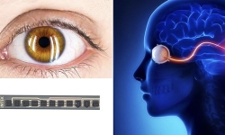 vision-implant